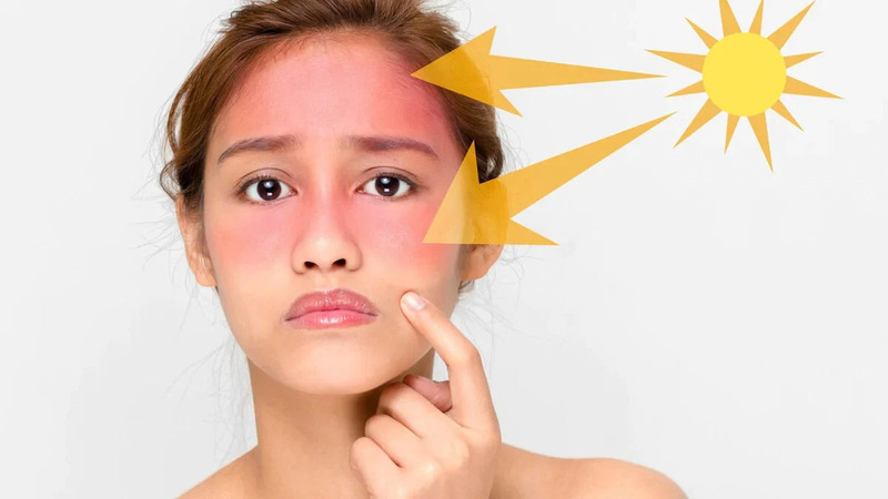 Tác hại của tia UV đến làn da phụ nữ